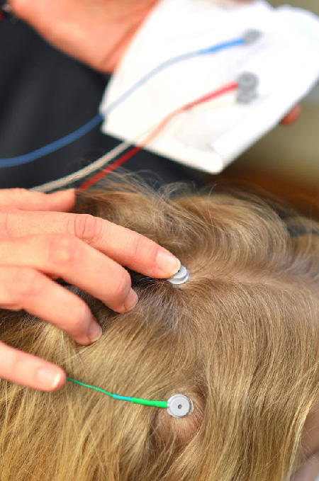 Neurofeedback Neurofeedback